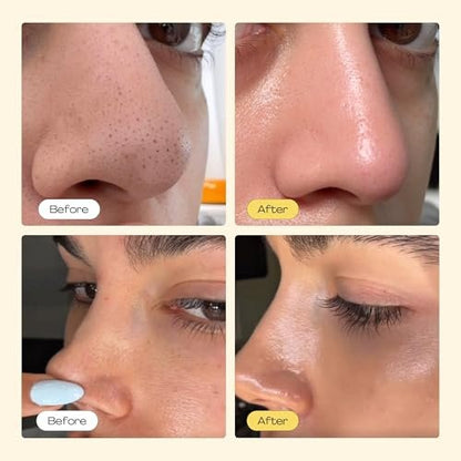 Luelle Pore Strips – Deep Cleansing Patch System, 100 PCS Blackhead Remover Peel Off Mask for Face & Nose Avelisse