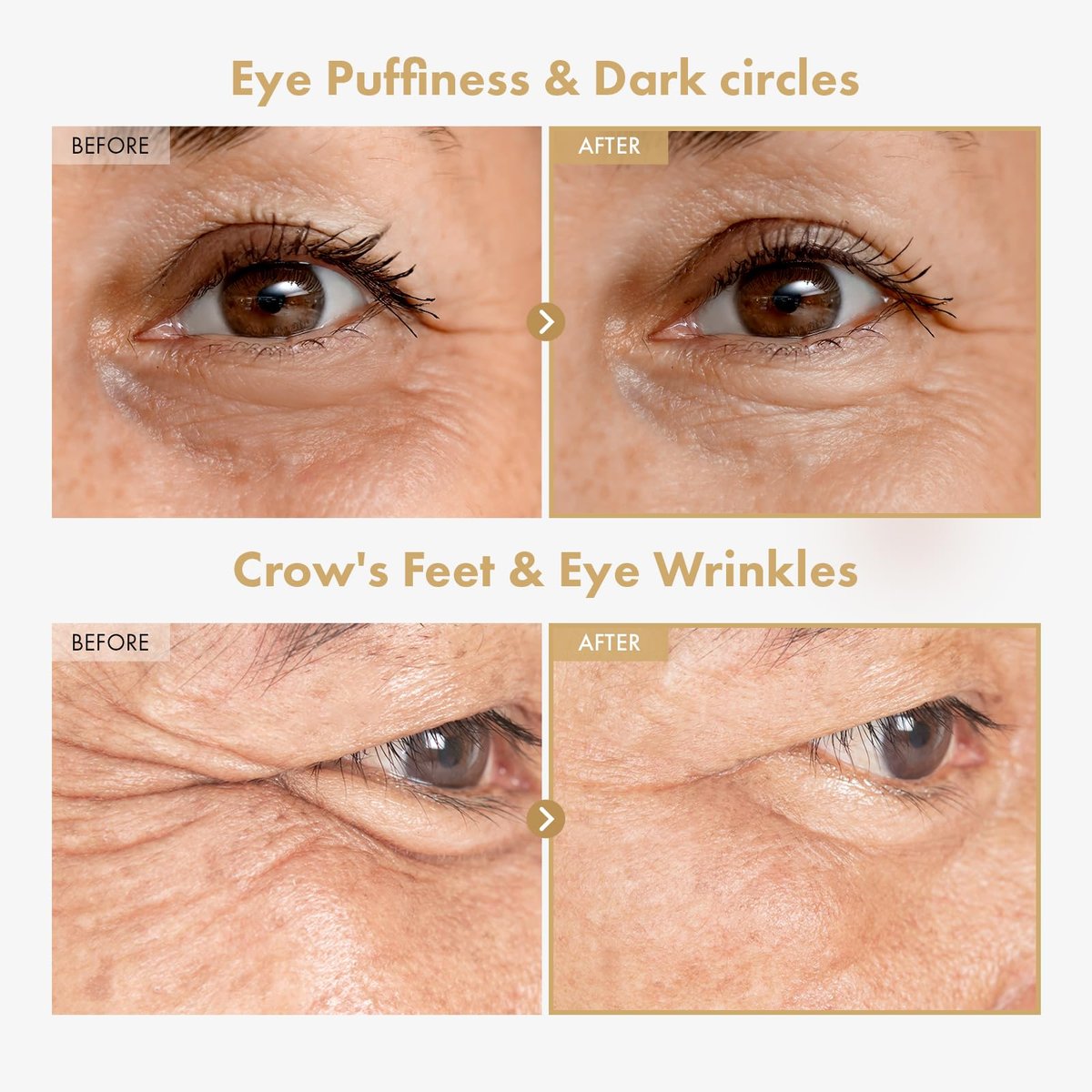 TOSOWOONG Ginseng Plus Retinal Eye Serum - Korean Anti-Aging Eye Cream with Retinal, Niacinamide & Bakuchiol for Puffy Eyes, Dark Circles, Fine Lines & Wrinkles, 1.01 fl.oz. - görsel 3
