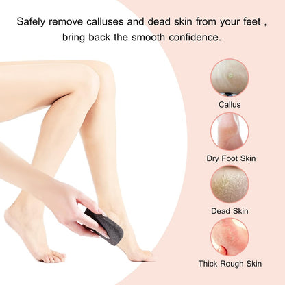SAMEBUTECO Natural Volcanic Pumice Stone for Feet - 3 Shapes Deep Clean Foot Scrubber, Dead Skin Remover, Black (Pack of 3)