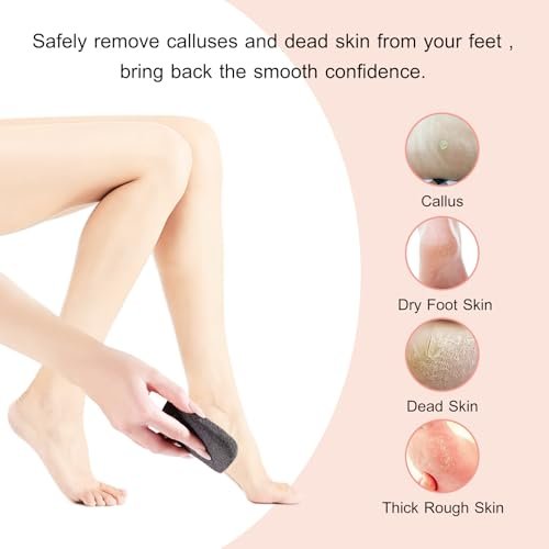SAMEBUTECO Natural Volcanic Pumice Stone for Feet - 3 Shapes Deep Clean Foot Scrubber, Dead Skin Remover, Black (Pack of 3) - görsel 10