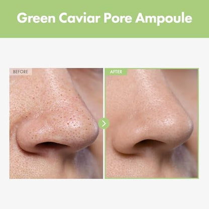 TOSOWOONG Green Caviar Pore Ampoule – 2,500ppm Green Caviar & Niacinamide for Pore Minimizing, Hydrating, Firming & Tightening – Korean Skin Care, 33ml Avelisse