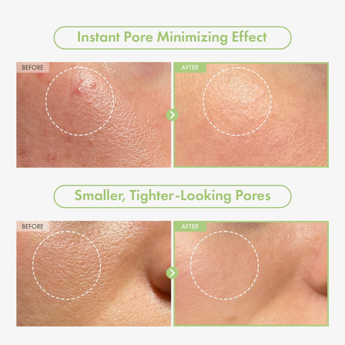 TOSOWOONG Green Caviar Pore Ampoule – 2,500ppm Green Caviar & Niacinamide for Pore Minimizing, Hydrating, Firming & Tightening – Korean Skin Care, 33ml Avelisse