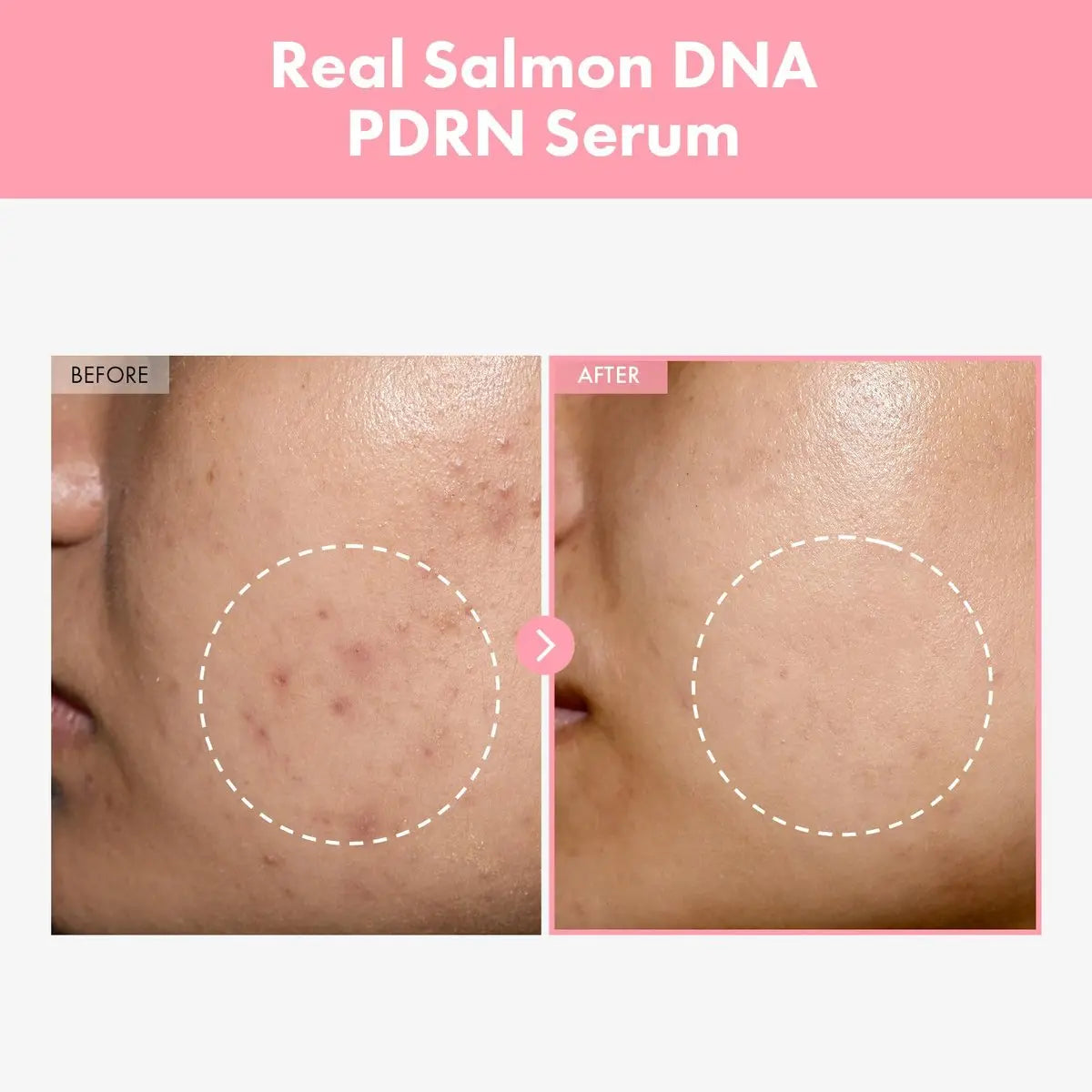 TOSOWOONG Pink Peptide 12 PDRN Serum - Salmon DNA PDRN 10,320ppm, 12 Peptides, Niacinamide, Hydrating & Firming Korean Skincare, 33ml Avelisse