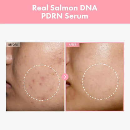TOSOWOONG Pink Peptide 12 PDRN Serum - Salmon DNA PDRN 10,320ppm, 12 Peptides, Niacinamide, Hydrating & Firming Korean Skincare, 33ml Avelisse