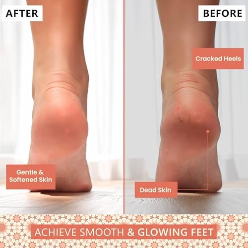 Natural Terracotta Pumice Stone for Feet – Handcrafted Foot Scrubber & Callus Remover with Gentle Exfoliation and Ergonomic Design for Smooth, Soft & Refreshed Feet – for a Spa-Like Pedicure Avelisse