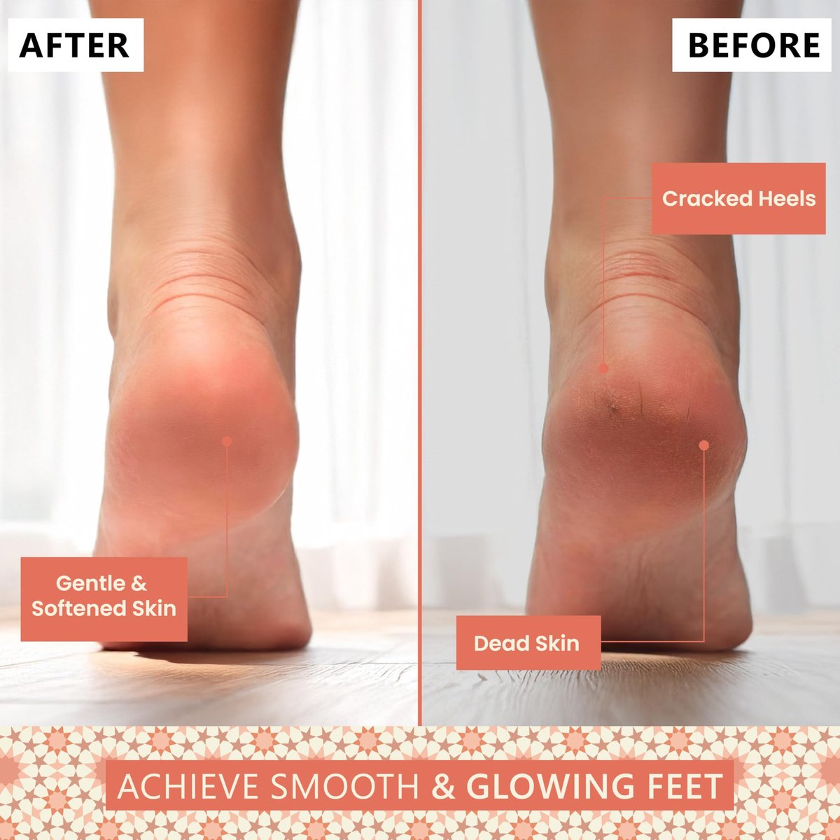 Natural Terracotta Pumice Stone for Feet – Handcrafted Foot Scrubber & Callus Remover with Gentle Exfoliation and Ergonomic Design for Smooth, Soft & Refreshed Feet – for a Spa-Like Pedicure Avelisse