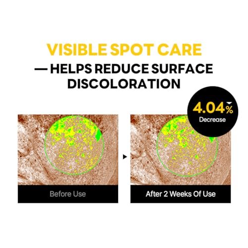 ROUND LAB Vita Niacinamide Dark Spot Cream 1.69 Fl Oz – Tone Clarity Moisturizer with Tranexamic Acid & Vitamin Complex for Dark Spot Care, Uneven Skin Texture & Radiance – Korean Skincare Avelisse