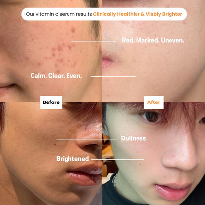 Purify. Puréel 20% Vitamin C Serum for Face – Brightening Serum with Vitamin E & Ferulic Acid – Anti-Aging, Dark Spot Remover, Even Skin Tone, Wrinkle Reduction & Radiant Glow – 1 fl oz Avelisse