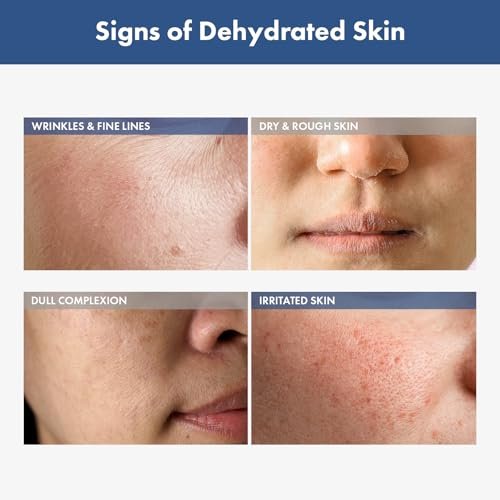 TOSOWOONG Hyaluronic Acid 3% Serum - 30,030ppm Sodium Hyaluronic Acid for Intense Hydration, Plump & Repair Dry Skin, Korean Skin Care, 30ml - görsel 6