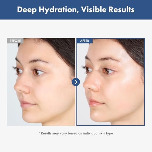 TOSOWOONG Hyaluronic Acid 3% Serum - 30,030ppm Sodium Hyaluronic Acid for Intense Hydration, Plump & Repair Dry Skin, Korean Skin Care, 30ml - görsel 8