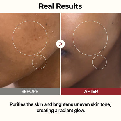 Dr.Melaxin Peel Shot Glow Rice Toner with Rice Extract & Ceramides - Hydrating & Skin Refining Face Toner for Glass Skin, Korean Skincare, 6.76 fl.oz Avelisse