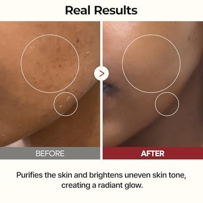 Dr.Melaxin Peel Shot Glow Rice Toner with Rice Extract & Ceramides - Hydrating & Skin Refining Face Toner for Glass Skin, Korean Skincare, 6.76 fl.oz Avelisse