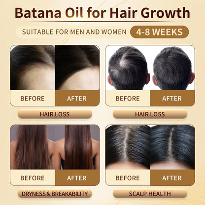 Orrhomi 100% Pure & Organic Batana Oil for Hair Growth, Cold Pressed Unrefined, 4.23 Fl Oz