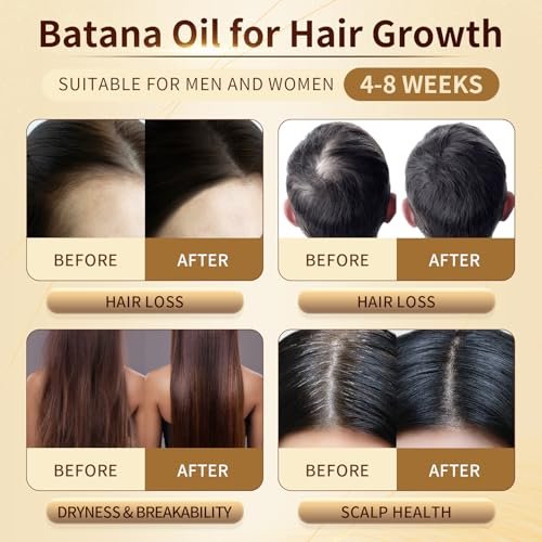 Orrhomi 100% Pure & Organic Batana Oil for Hair Growth, Cold Pressed Unrefined, 4.23 Fl Oz - görsel 10