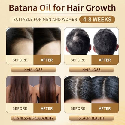 Orrhomi 100% Pure & Organic Batana Oil for Hair Growth, Cold Pressed Unrefined, 4.23 Fl Oz
