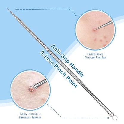 Vybiekr Stainless Steel Blackhead Remover – Surgical Grade Pimple Extractor for Face, Nose & T-Zone (2-Piece Kit)