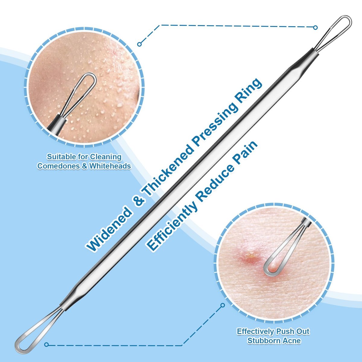 Vybiekr Stainless Steel Blackhead Remover – Surgical Grade Pimple Extractor for Face, Nose & T-Zone (2-Piece Kit) - görsel 5