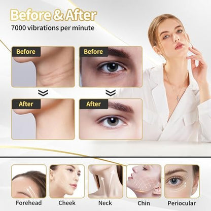 Lyndops Portable Face Beauty Device - 7 Color LED, Thermal & Vibration Face Massager for At-Home Skin Care, Anti-Aging Face Sculpting Tool (Glossy Black) Avelisse
