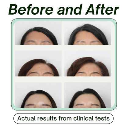 SRILabs KEEWEE Hair Growth Shampoo with Biotin, Niacinamide, Green Tea & Ginkgo – Thickening for Thinning Hair & Hair Loss | Sulfate-Free, Color-Safe, Scalp-Calming Avelisse