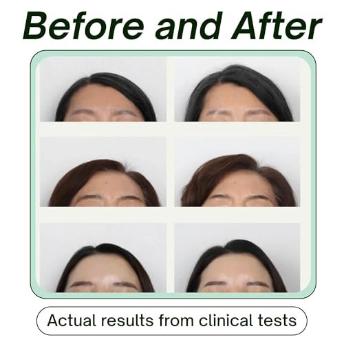 SRILabs KEEWEE Hair Growth Shampoo with Biotin, Niacinamide, Green Tea & Ginkgo – Thickening for Thinning Hair & Hair Loss | Sulfate-Free, Color-Safe, Scalp-Calming Avelisse