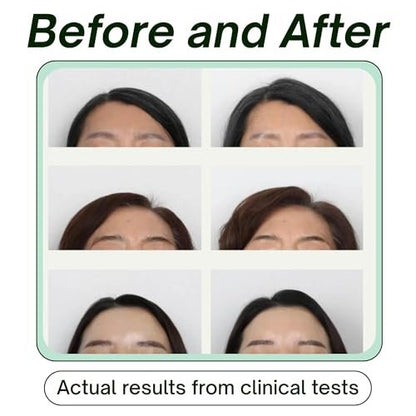 SRILabs KEEWEE Hair Growth Shampoo with Biotin, Niacinamide, Green Tea & Ginkgo – Thickening for Thinning Hair & Hair Loss | Sulfate-Free, Color-Safe, Scalp-Calming Avelisse