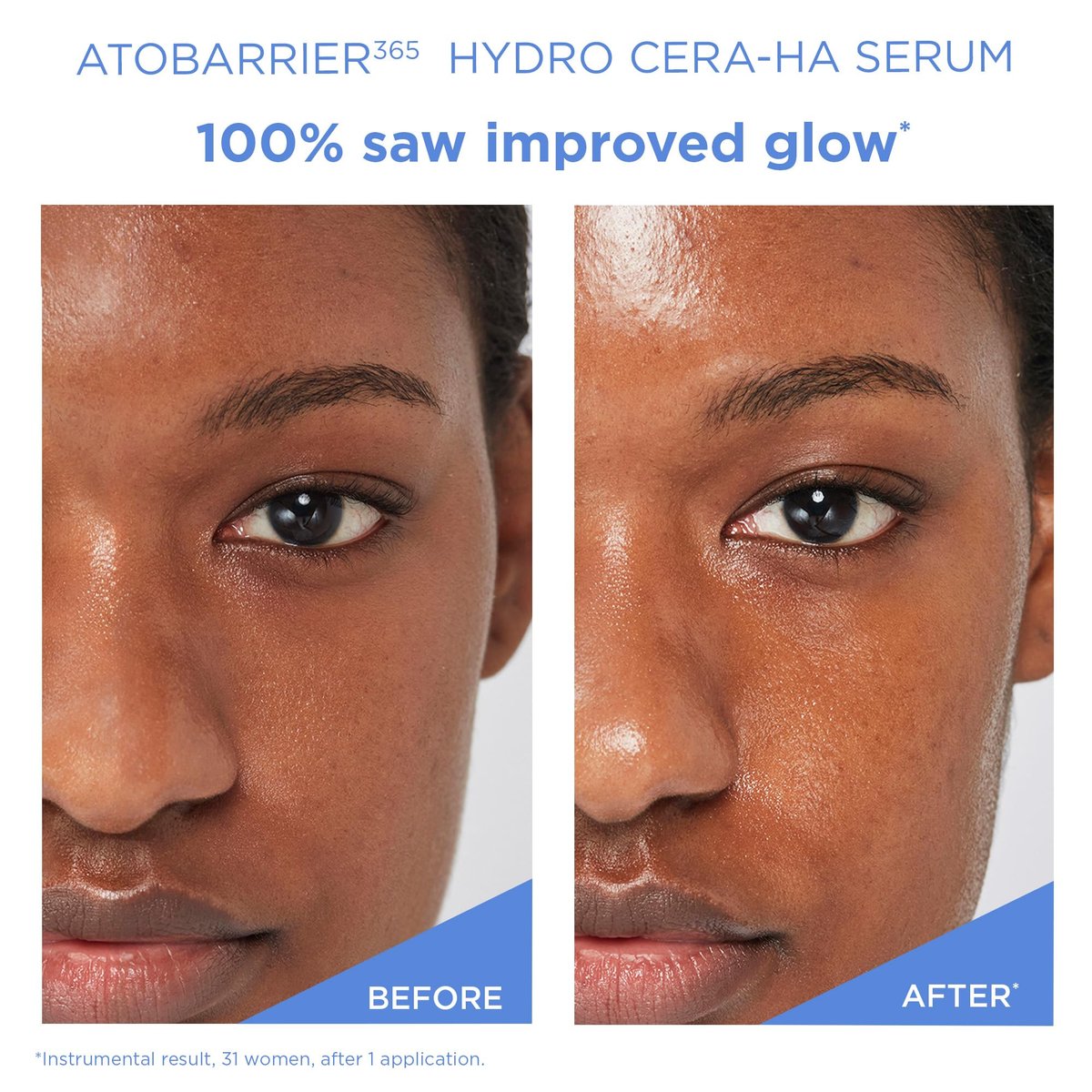 AESTURA ATOBARRIER365 Hydro CERA-HA Serum - Korean Face Serum with Ceramides, Hyaluronic Acid & Niacinamide for Barrier Repair & Glow - Lightweight Hydrating Serum for Dry & Sensitive Skin, 1.01 fl.oz Avelisse