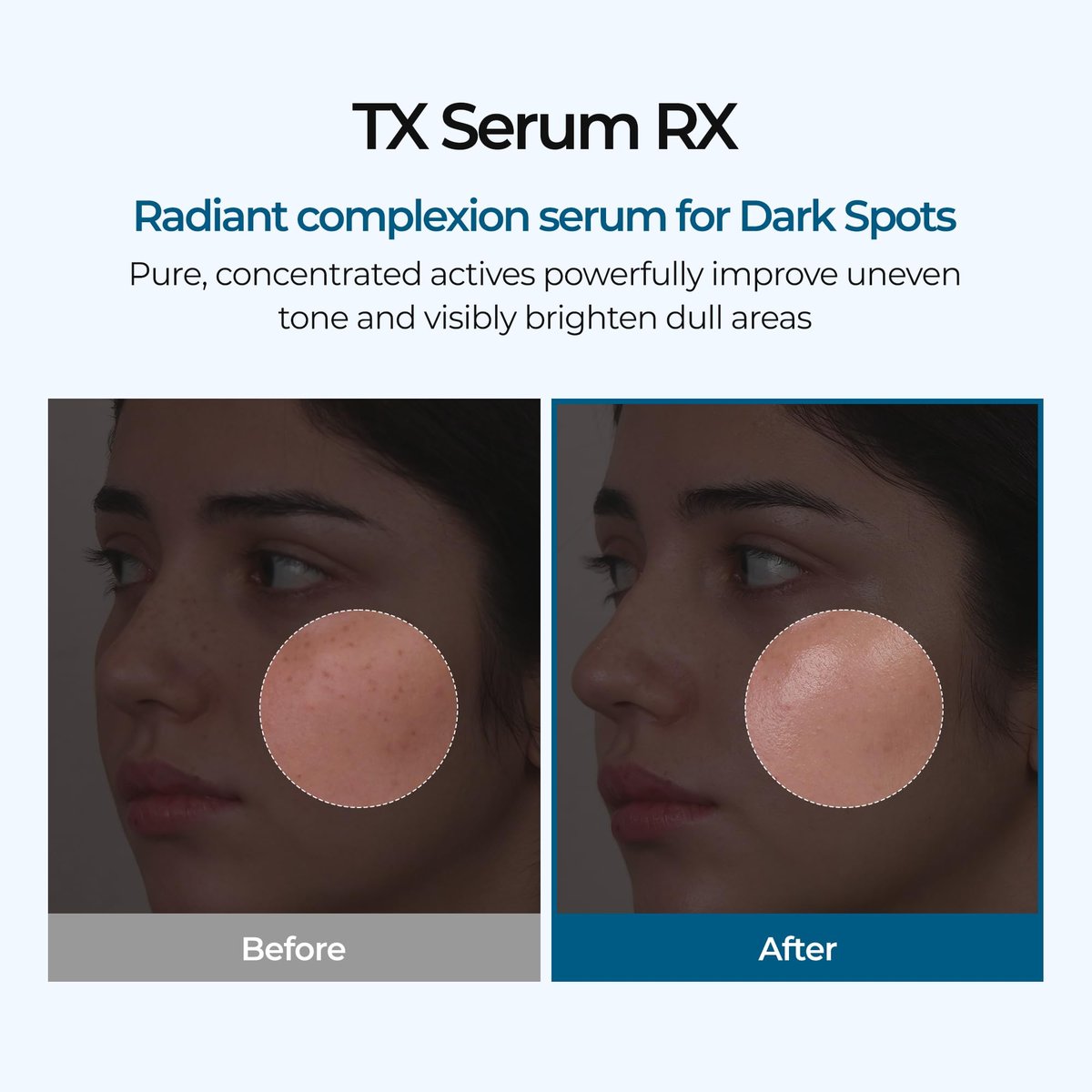Dr.melaxin TX Ampoule RX Facial Ampoule – Brightening & Soothing Serum Avelisse