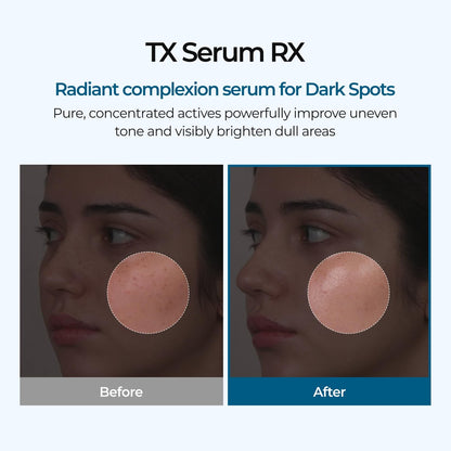 Dr.melaxin TX Ampoule RX Facial Ampoule – Brightening & Soothing Serum Avelisse