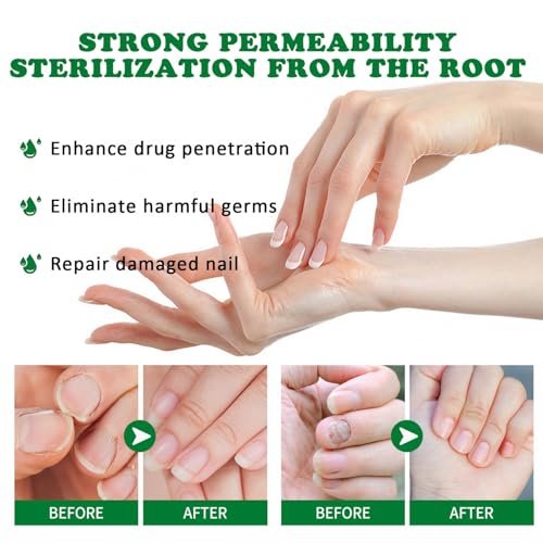 LOYOTICE 3Pcs Ginger Nail Treatment & Growth Serum – Strengthener & Cuticle Care Oil for Healthy Nails (30ml Each) - görsel 8