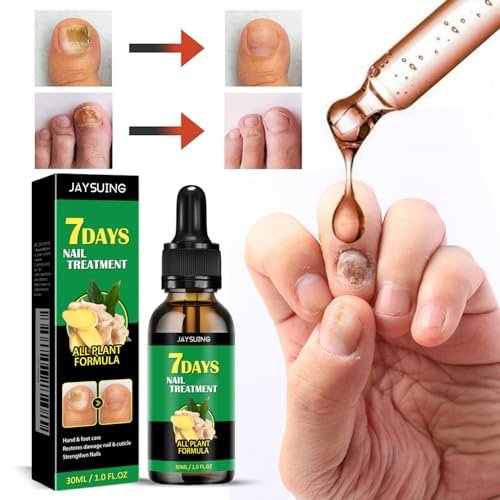 LOYOTICE 3Pcs Ginger Nail Treatment & Growth Serum – Strengthener & Cuticle Care Oil for Healthy Nails (30ml Each) - görsel 4