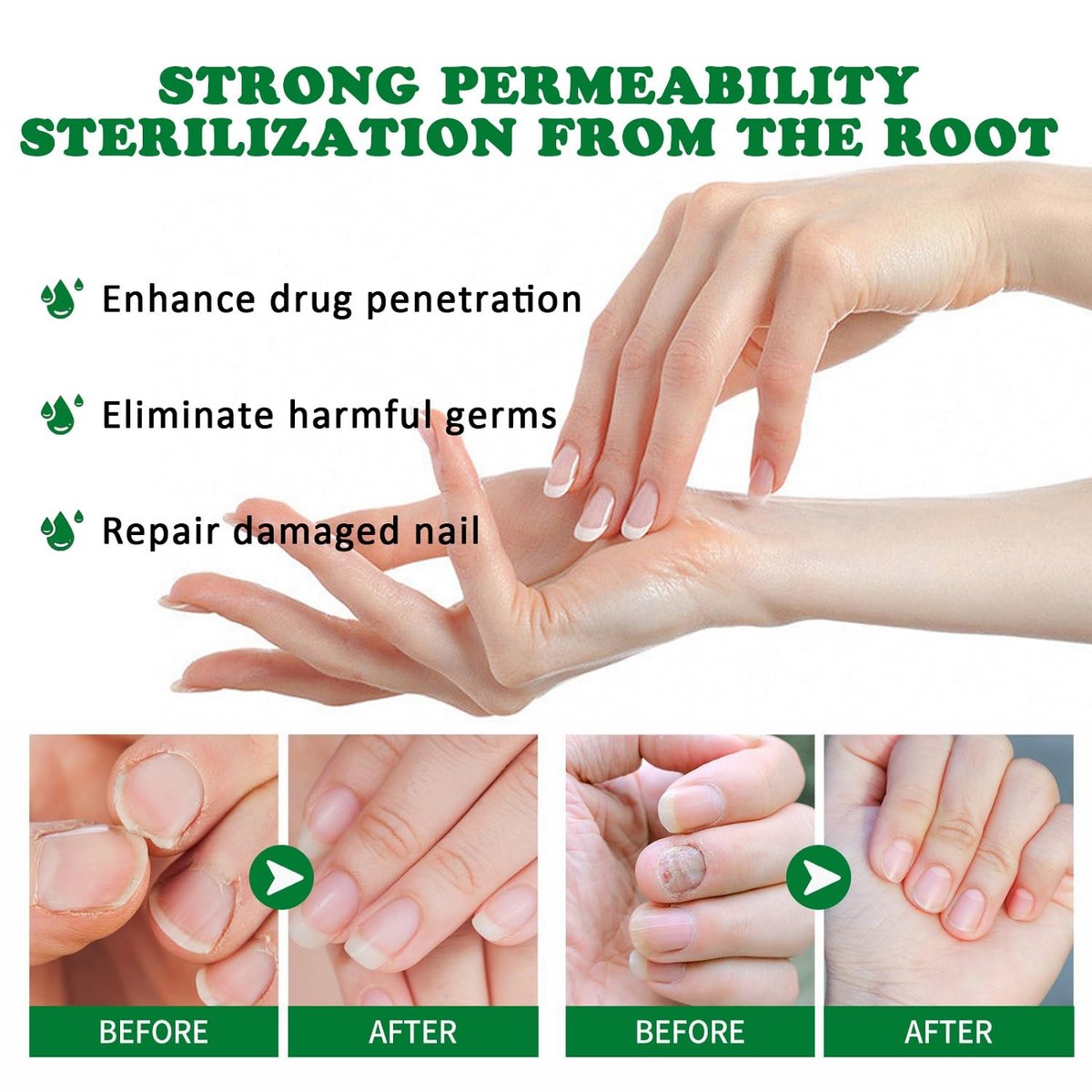 LOYOTICE 3Pcs Ginger Nail Treatment & Growth Serum – Strengthener & Cuticle Care Oil for Healthy Nails (30ml Each) - görsel 7