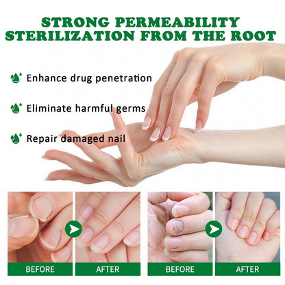 LOYOTICE 3Pcs Ginger Nail Treatment & Growth Serum – Strengthener & Cuticle Care Oil for Healthy Nails (30ml Each)