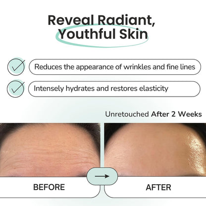 Advanced Forehead Wrinkle Patches Overnight – Anti-Wrinkle Patches with Collagen, Peptides, Vitamin E – Strong Adhesion Full Coverage for Forehead Wrinkles & 11 Lines – Made in Korea – 10 Count Avelisse