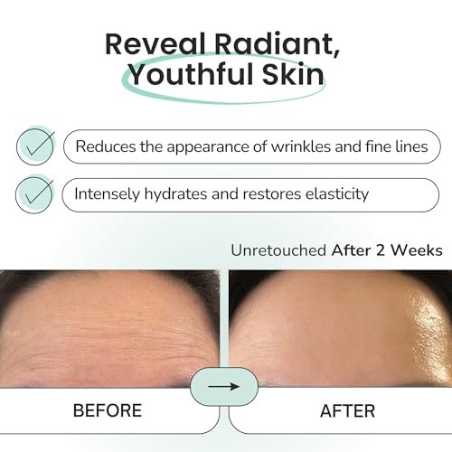 Advanced Forehead Wrinkle Patches Overnight – Anti-Wrinkle Patches with Collagen, Peptides, Vitamin E – Strong Adhesion Full Coverage for Forehead Wrinkles & 11 Lines – Made in Korea – 10 Count Avelisse