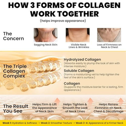 Chillihaer 8-in-1 Neck Firming Cream – Retinol & Triple Collagen Moisturizer for Neck, Face, Chest & Décolleté – Tighten, Lift & Smooth the Look of Sagging Crepey Skin, Fine Lines & Wrinkles – Women & Men, 1.7 Fl Oz Avelisse
