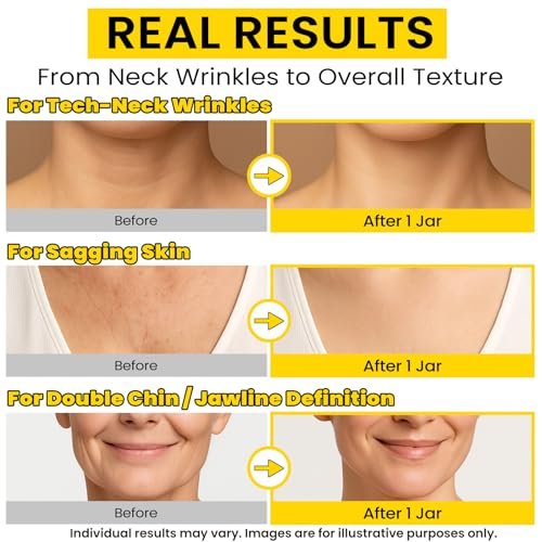 Chillihaer 8-in-1 Neck Firming Cream – Retinol & Triple Collagen Moisturizer for Neck, Face, Chest & Décolleté – Tighten, Lift & Smooth the Look of Sagging Crepey Skin, Fine Lines & Wrinkles – Women & Men, 1.7 Fl Oz Avelisse