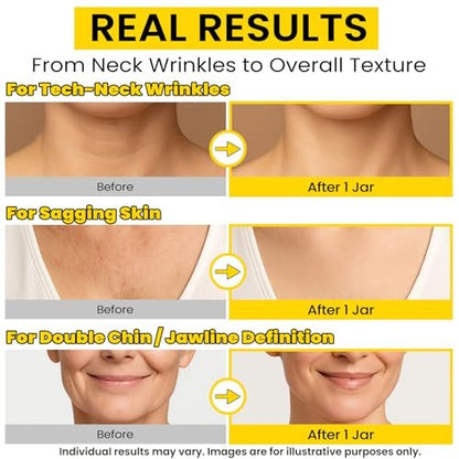 Chillihaer 8-in-1 Neck Firming Cream – Retinol & Triple Collagen Moisturizer for Neck, Face, Chest & Décolleté – Tighten, Lift & Smooth the Look of Sagging Crepey Skin, Fine Lines & Wrinkles – Women & Men, 1.7 Fl Oz Avelisse