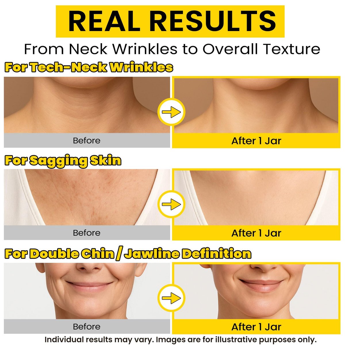 Chillihaer 8-in-1 Neck Firming Cream – Retinol & Triple Collagen Moisturizer for Neck, Face, Chest & Décolleté – Tighten, Lift & Smooth the Look of Sagging Crepey Skin, Fine Lines & Wrinkles – Women & Men, 1.7 Fl Oz Avelisse