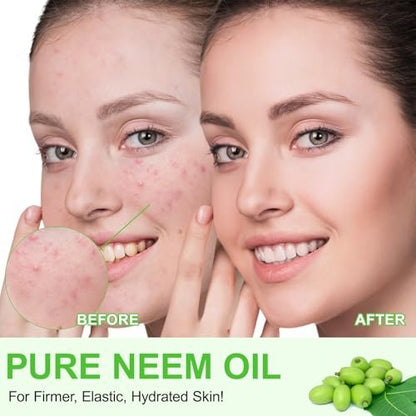 APUUFYQC Pure Neem Oil for Skin & Hair - Cold Pressed, Hexane Free, 2.02 oz