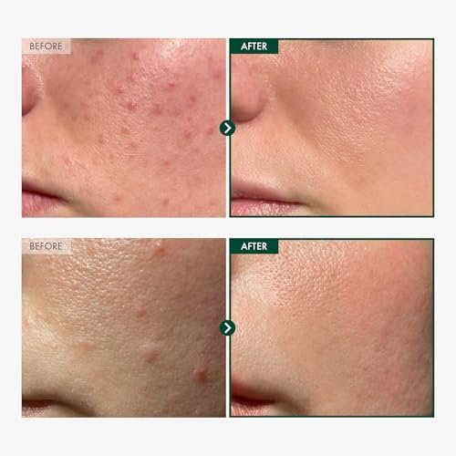 TOSOWOONG Madagascar Centella 86% Ampoule – Soothing & Calming Facial Serum for All Skin Types (100ml / 3.38 fl.oz.) - görsel 4