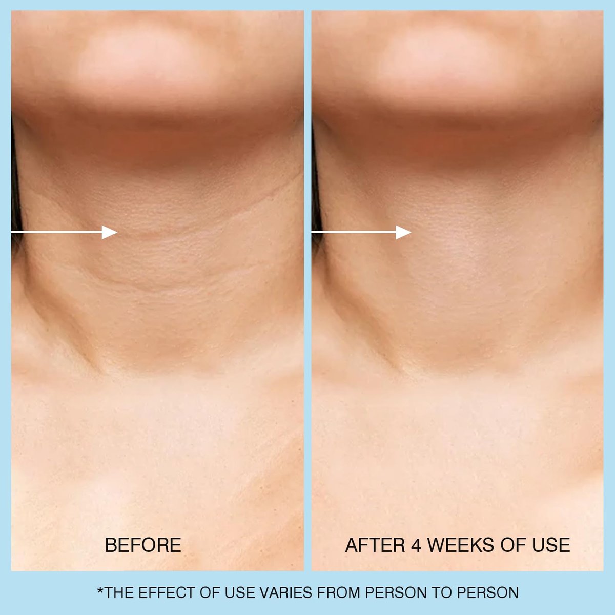 UJhay Retinol Neck Cream with Hyaluronic Acid & Caffeine - Firming Moisturizer for Neck, Chest & Face (1.7 oz) - görsel 9