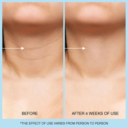 UJhay Retinol Neck Cream with Hyaluronic Acid & Caffeine - Firming Moisturizer for Neck, Chest & Face (1.7 oz)