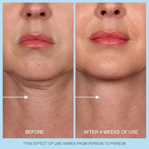 UJhay Retinol Neck Cream with Hyaluronic Acid & Caffeine - Firming Moisturizer for Neck, Chest & Face (1.7 oz) - görsel 12