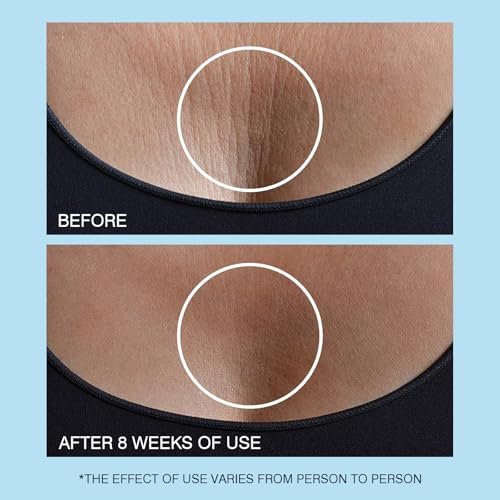 UJhay Retinol Neck Cream with Hyaluronic Acid & Caffeine - Firming Moisturizer for Neck, Chest & Face (1.7 oz) - görsel 14