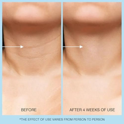 UJhay Retinol Neck Cream with Hyaluronic Acid & Caffeine - Firming Moisturizer for Neck, Chest & Face (1.7 oz)