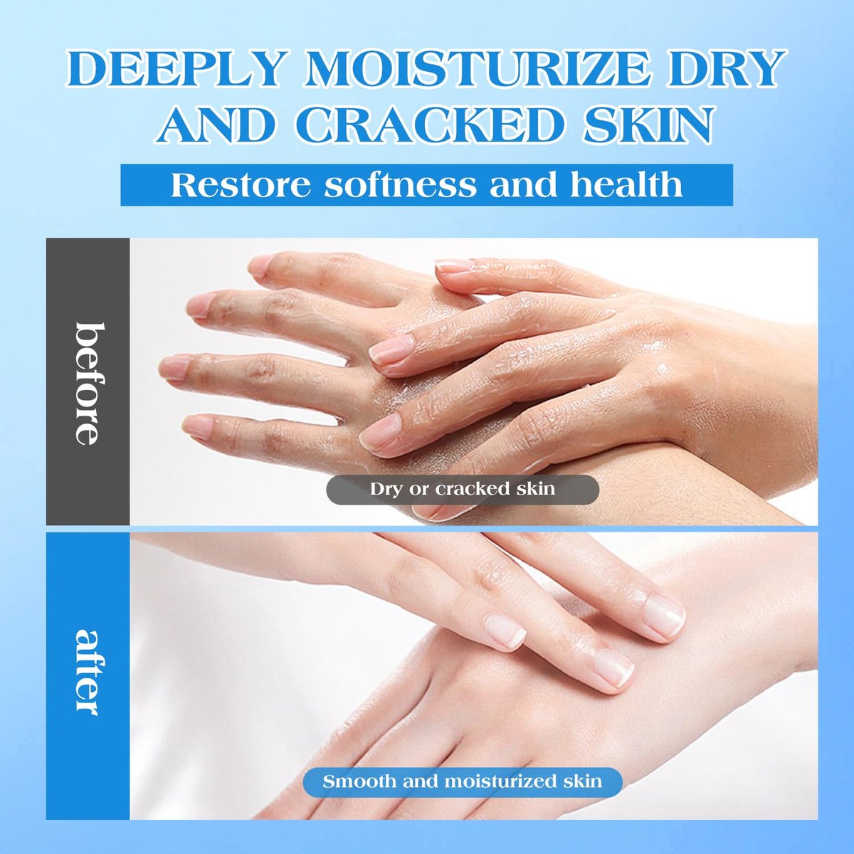 42% Urea Cream for Dry & Cracked Skin - Maximum Strength Foot & Hand Cream with 2% Salicylic Acid, 5% Vitamin E, Tea Tree Oil, Aloe Vera, Shea Butter - Moisturizer & Skin Repair Cream for Feet - görsel 9