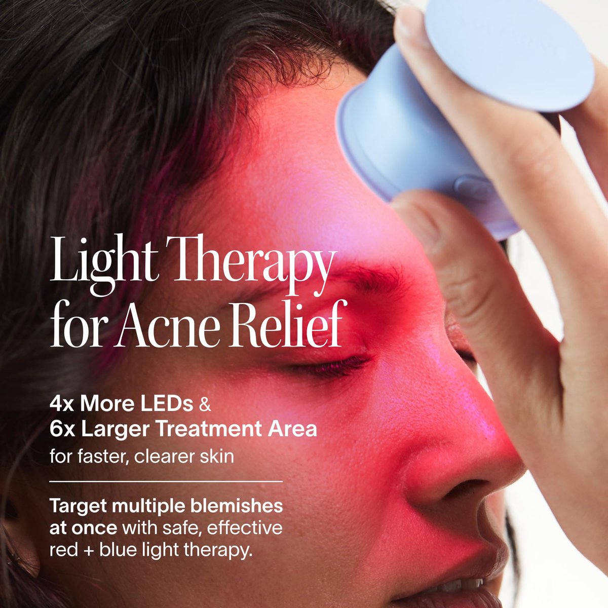 Solawave Bye Acne: Blue & Red Light Therapy Wand for Face & Body – LED Device Reduces Redness, Pimples, Zits & Blemishes, Calms Inflammation, 3-Min Treatment, Easy to Use Avelisse
