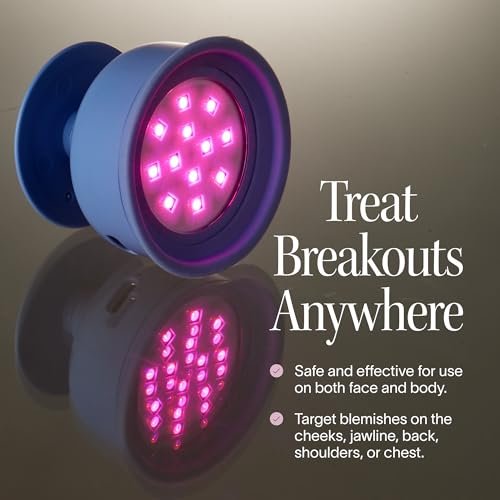 Solawave Bye Acne: Blue & Red Light Therapy Wand for Face & Body – LED Device Reduces Redness, Pimples, Zits & Blemishes, Calms Inflammation, 3-Min Treatment, Easy to Use Avelisse