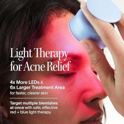 Solawave Bye Acne: Blue & Red Light Therapy Wand for Face & Body – LED Device Reduces Redness, Pimples, Zits & Blemishes, Calms Inflammation, 3-Min Treatment, Easy to Use Avelisse