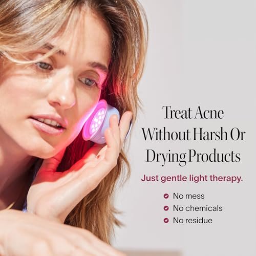 Solawave Bye Acne: Blue & Red Light Therapy Wand for Face & Body – LED Device Reduces Redness, Pimples, Zits & Blemishes, Calms Inflammation, 3-Min Treatment, Easy to Use Avelisse